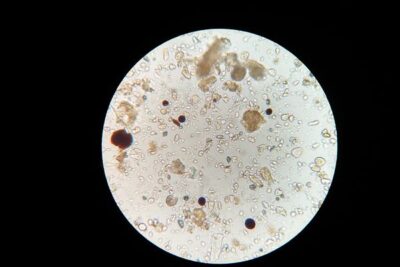 microscopic life